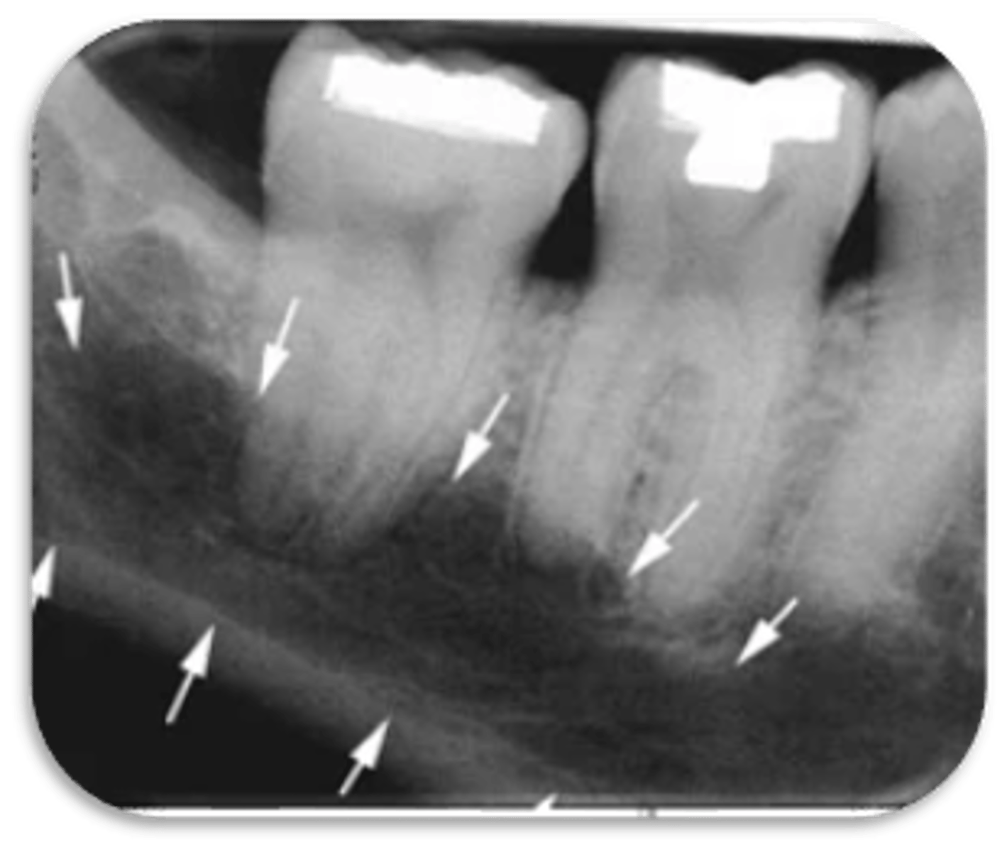 <p>ID the structure:</p>