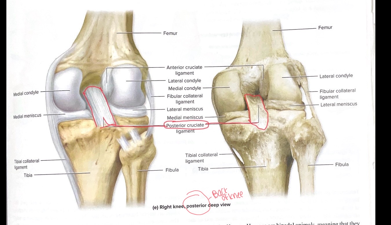 <p>Posterior Cruciate ligament (PCI)</p>