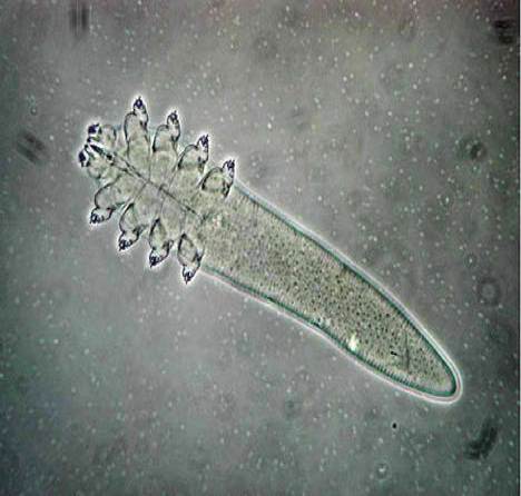 <p>is this Sarcopidae or non-sarcoptiform</p>