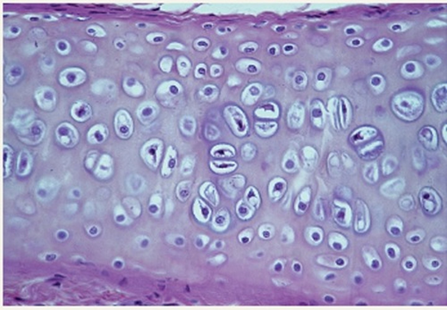 <p>Function - Supports and reinforces; Serves as resilient cushion; resists compressive stress</p><p>Location - Forms most of embryonic skeleton; covers ends of long bones in joint cavities; forms costal cartilages of ribs; cartilages of nose, trachea, and larynx.</p>