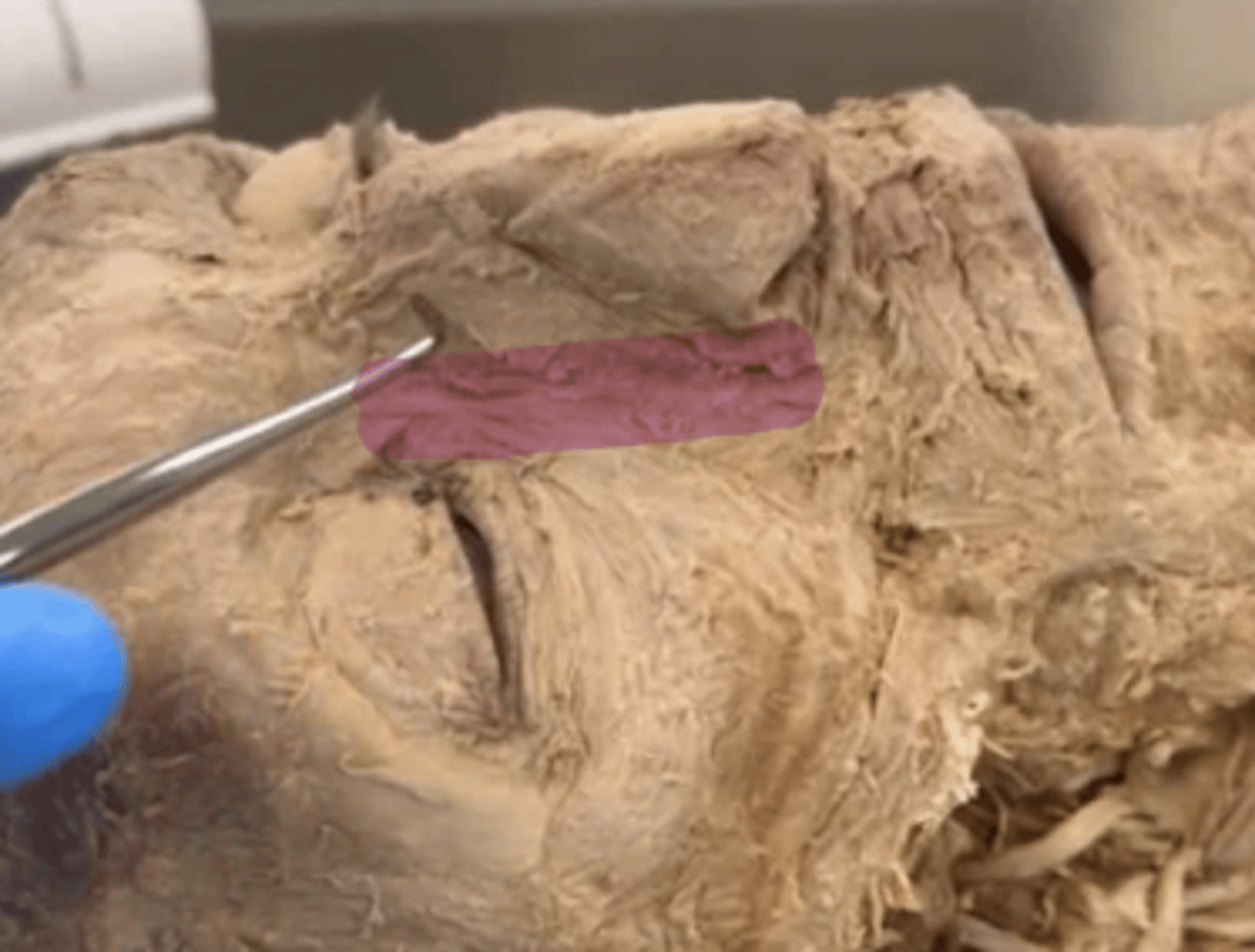 <p>Name the muscle.</p>