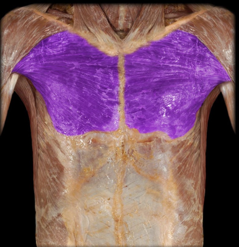 <p>Name the muscle highlighted (two words - all lowercase)</p>