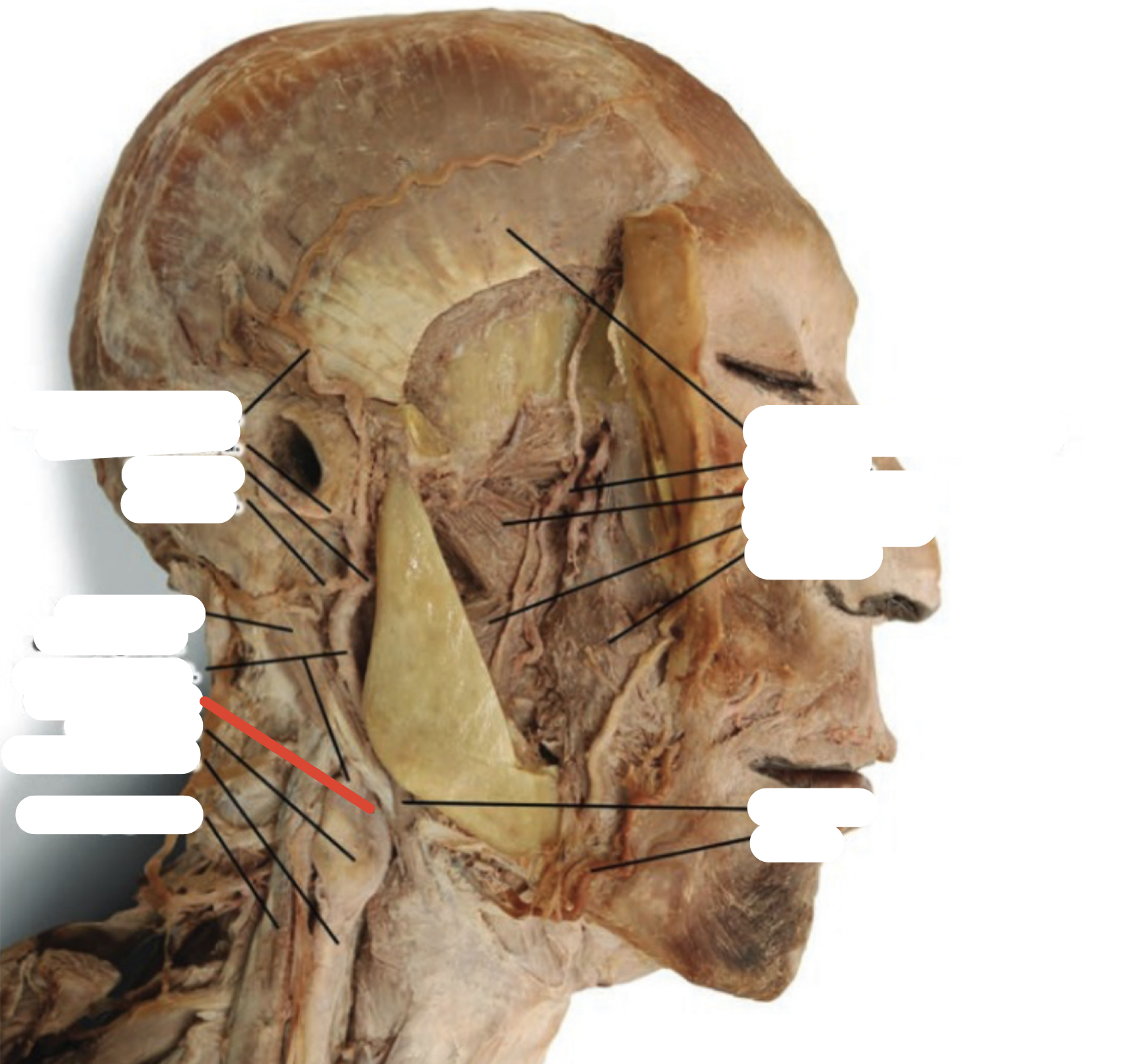 Identify the structure (red line)