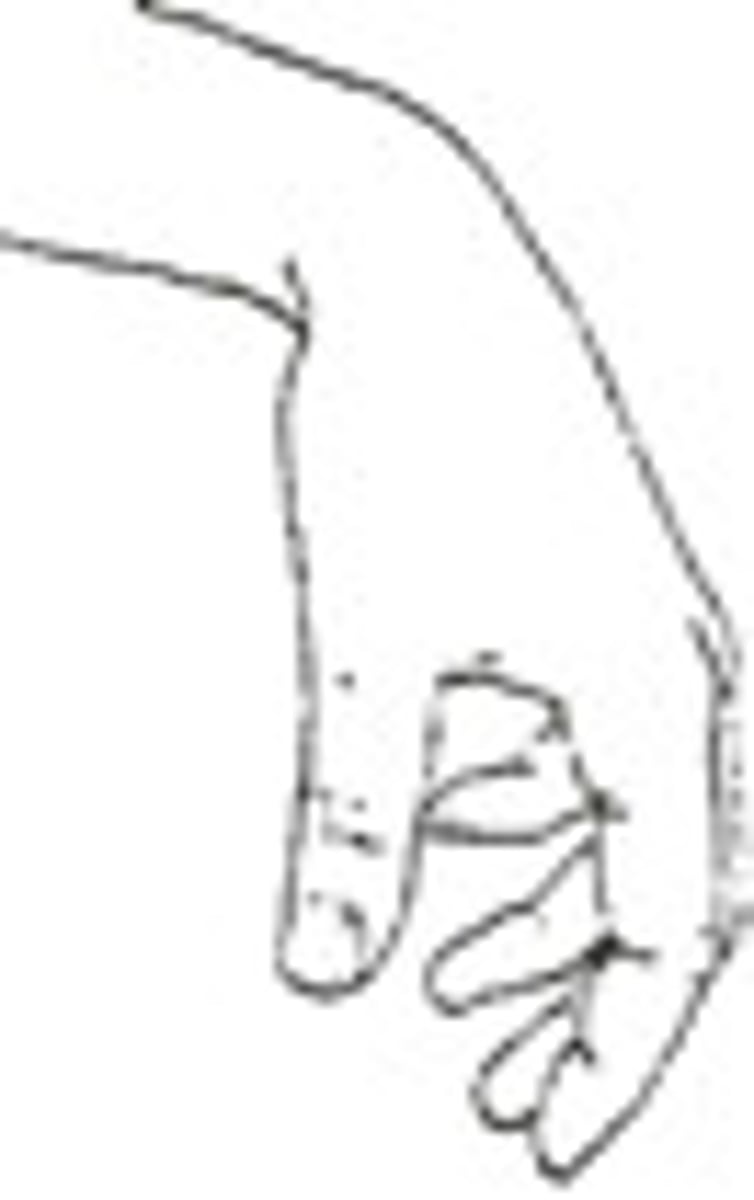 <p>Wrist Drop</p>