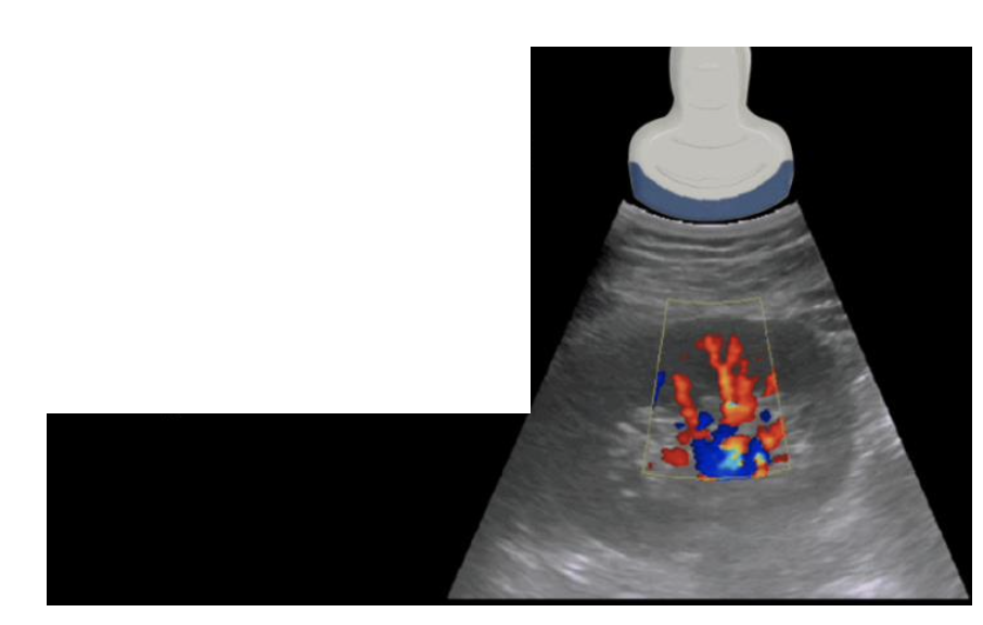 <p>The curvilinear ultrasound transducer</p>