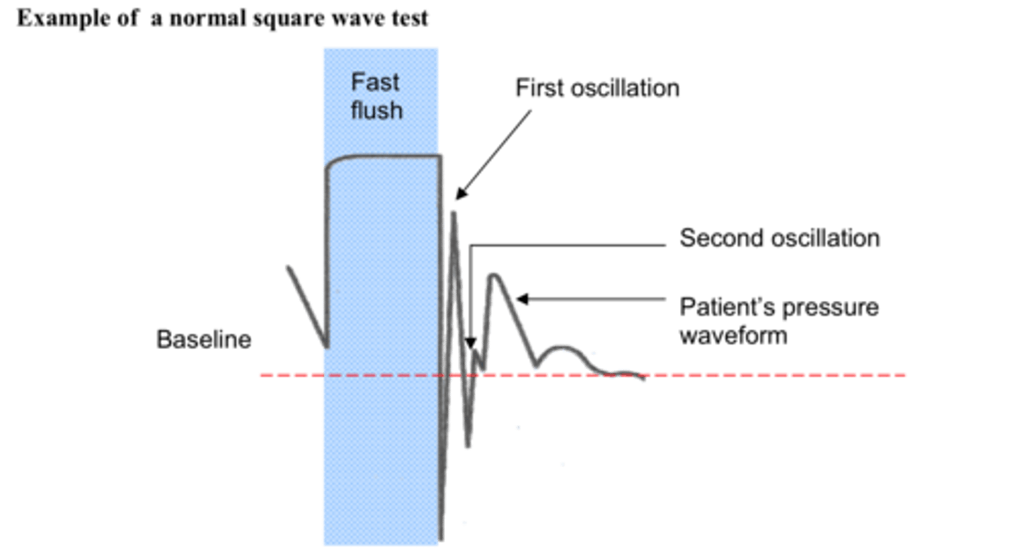 <p>pulling the flush valve opens it and the transducer reads the 300mmhg pressure from the pressure bag. This creates a sharp rise and a plateau in the wave form that drops off sharply when the valve is closed</p>