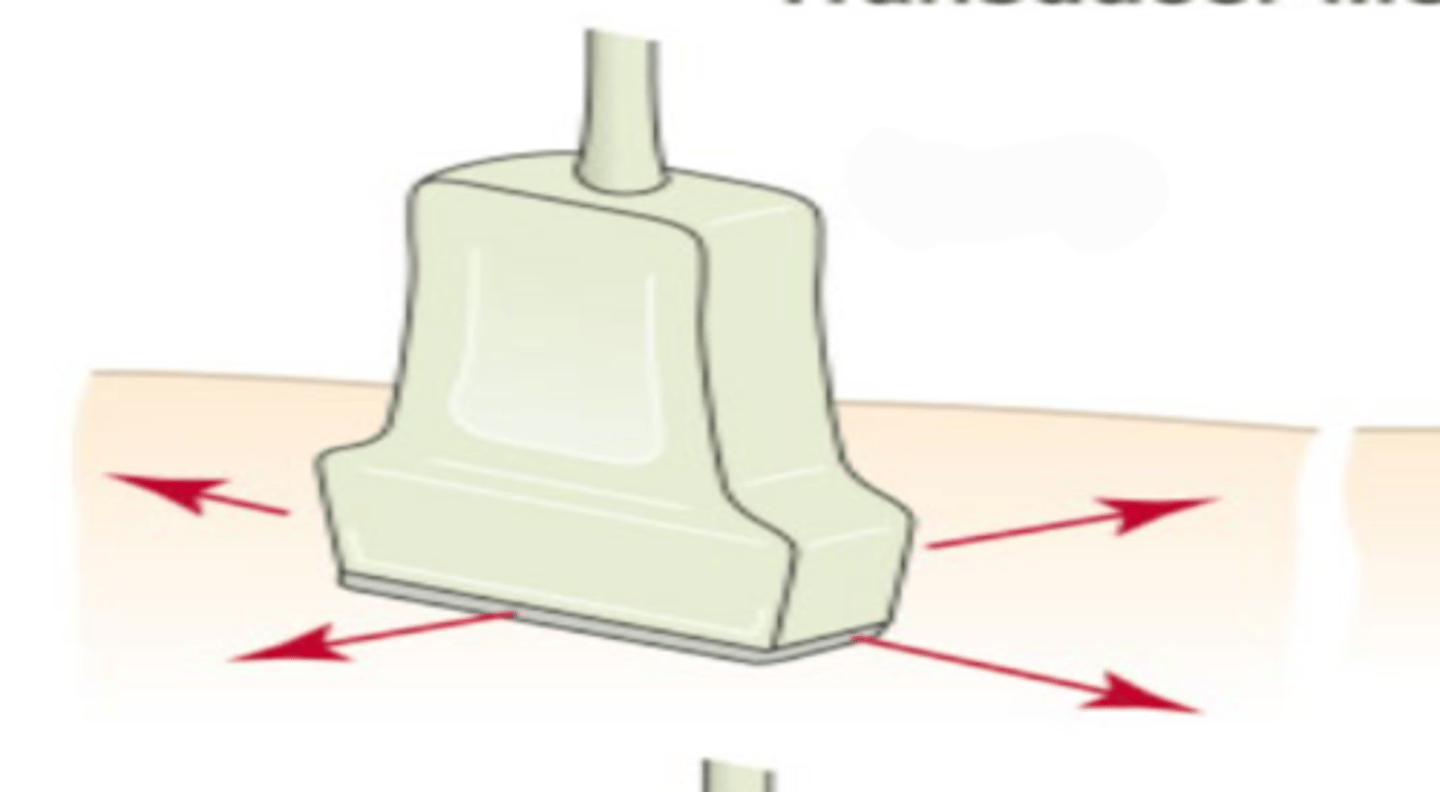 <p>what is this transducer movement called</p>