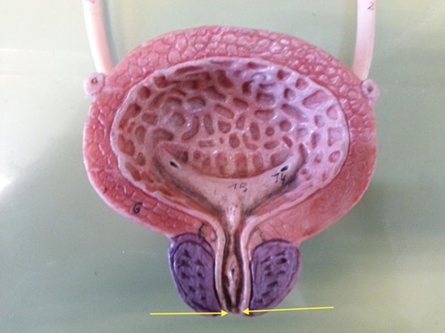 <p>Voluntary skeletal muscle ring surrounding the urethra as it passes through the pelvic floor, on its way out.</p>