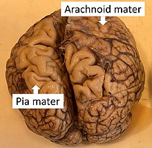 <p>Only 1-2 cell layers think (can’t see)</p>