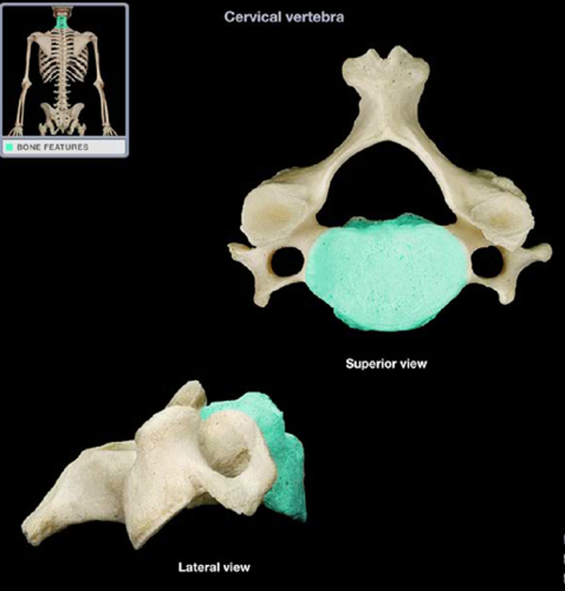 <p>solid anterior portion of a vertebra</p>