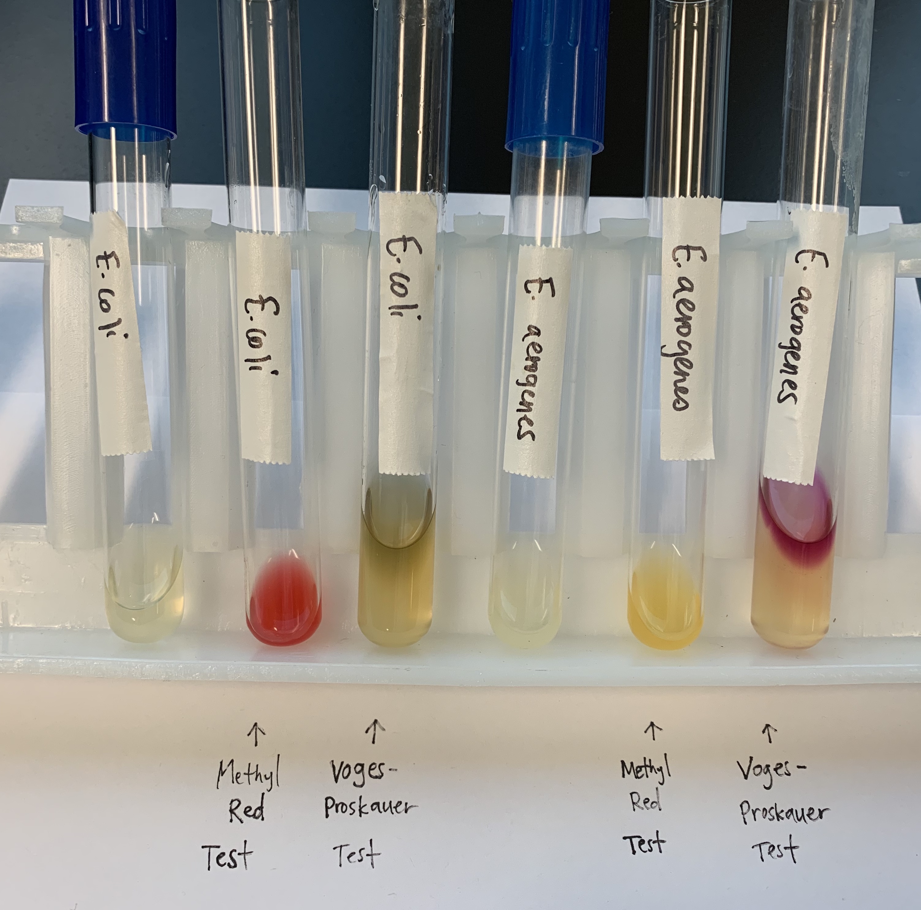 <p>What does a positive and negative test mean for the MRVP tests?</p>