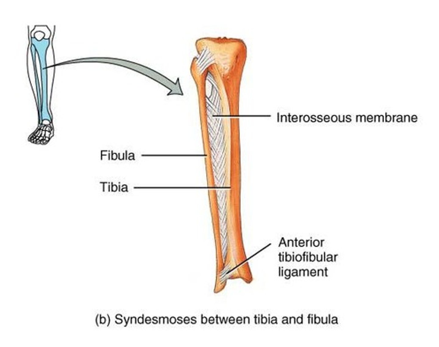 <p>2 bones bound by an interosseous membrane; slight movement (amphiarthrosis); between the tibia and fibula in the leg</p>