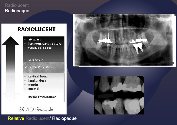 <ul><li><p>air space</p></li><li><p>foramen, canal, suture, fossa, pdl space</p></li><li><p>soft tissue</p></li></ul><p></p>