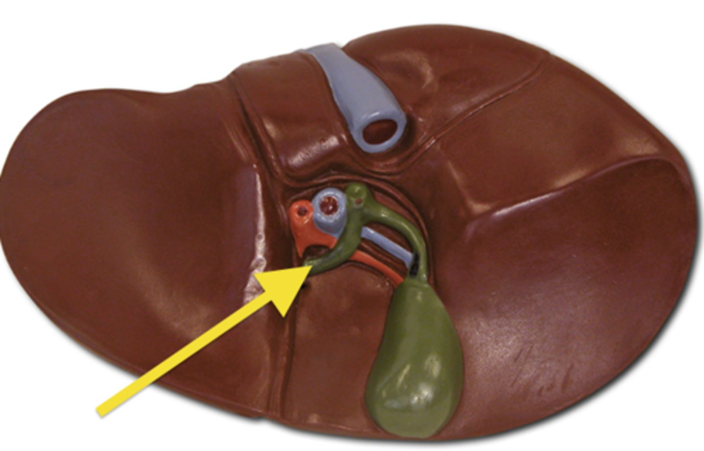 <p>What part of the gallbladder is this?</p>