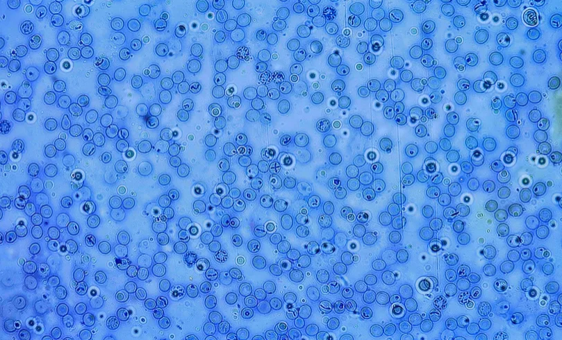 <p><span data-name="microscope" data-type="emoji">🔬</span><span data-name="petri_dish" data-type="emoji">🧫</span><strong><span> </span>Na podstawie zdjęcia preparatu:</strong></p><p></p><ul><li><p><span>📖 </span>rozpoznaj gatunek pasożyta;</p></li></ul><p></p><ul><li><p><span>♻ </span>rozpoznaj wszystkie formy rozwojowe;</p></li></ul><p></p><ul><li><p><span>🦠 </span>wskaż organelle i cechy charakterystyczne dla danego gatunku;</p></li></ul><p></p><ul><li><p><span>😷 </span>nazwij chorobę, którą pasożyt wywołuje.</p></li></ul><p></p>