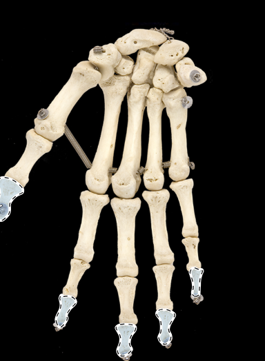 <p>Bones of the hand, overview, anterior view, right side</p>
