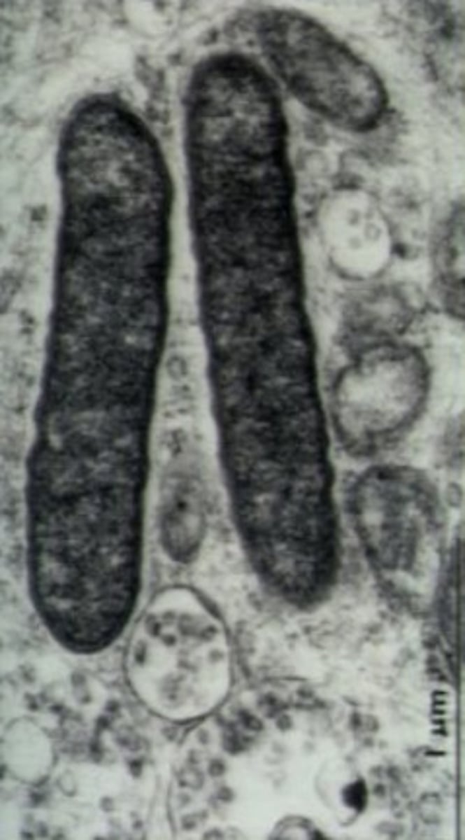 <p>Define CNS Infection Cause:</p><p>-Transmission from bacteria found in lice/fleas</p><p>-Can cause Rocky Mountain Spotted Fever</p>