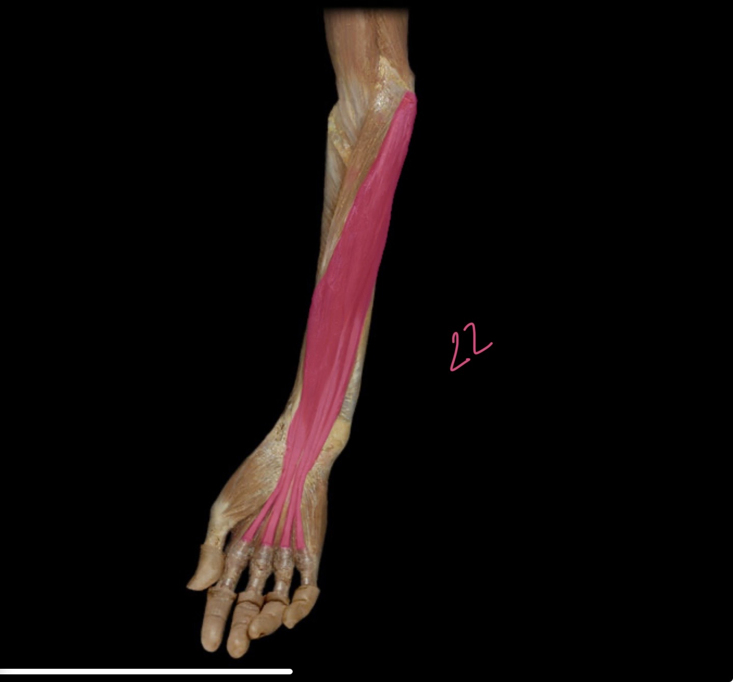 <p>Flexor digitorum</p>