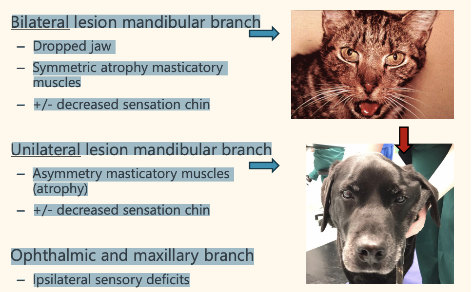 <p>Bilateral lesion mandibular branch – Dropped jaw – Symmetric atrophy masticatory muscles – +/- decreased sensation chin • Unilateral lesion mandibular branch – Asymmetry masticatory muscles (atrophy) – +/- decreased sensation chin • Ophthalmic and maxillary branch – Ipsilateral sensory deficits</p>