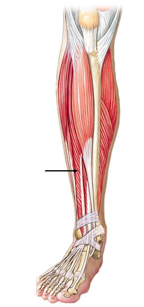 term image