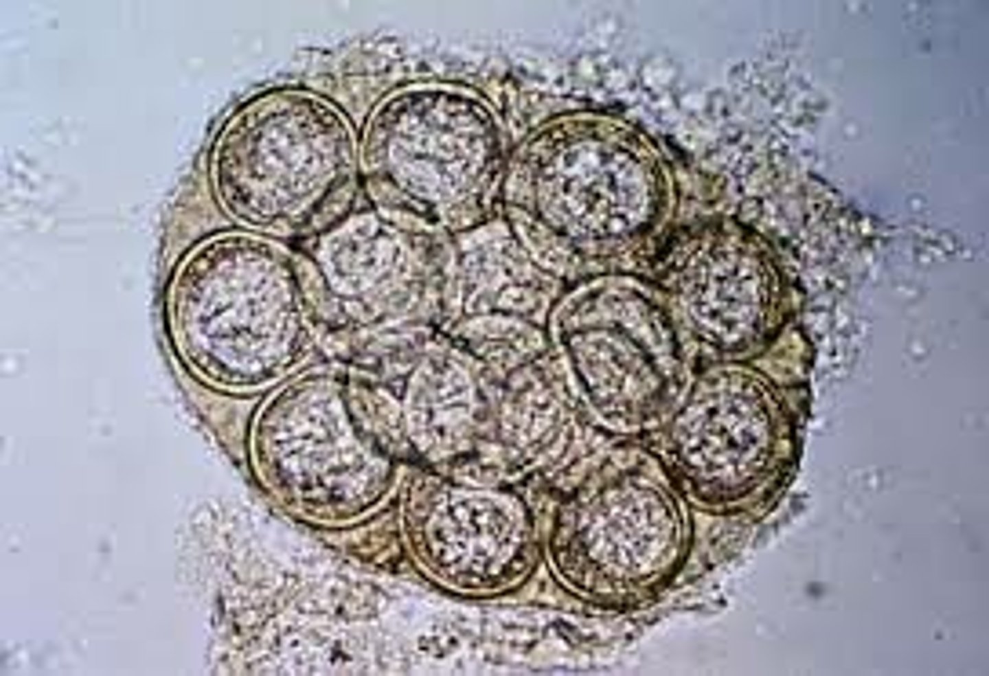 <p>2 common types (dipylidium caninum, and several members of the taenia genus) dogs, cats, and humans can get them. they are transmitted when a proglottids break off from the original worm and are shed in the feces. once they come into contact with dry air, the proglottids will release their egg packets. Dipylidium caninum tapeworms are contracted by ingesting infected fleas. the flea is the intermedite host. Taenia tapeworms are contracted by ingesting infected animals, like rodents.</p>