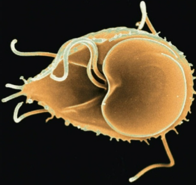 <p>What supergroup is this organism apart of?</p>