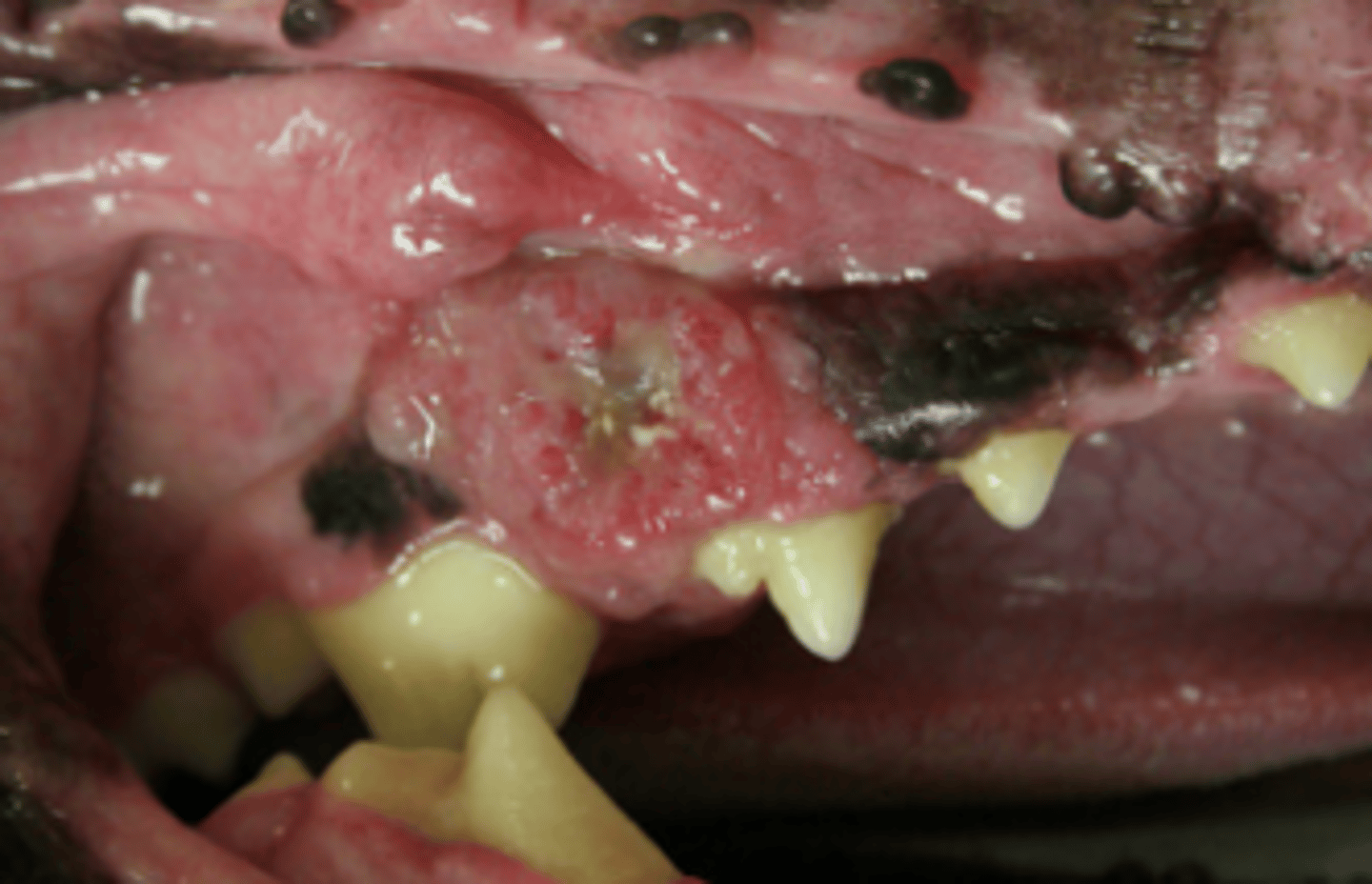 <p>- Not invasive, quite well behaved, surgery is usually curative</p><p>- Can form bone (ossifying epulis)</p>