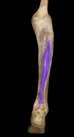 Action:
Flexion of great toe
Plantar flexion of foot
Inversion of foot
Innervation:
Tibial nerve
Comment:
Powerful muscle for "push-off" of foot during
walking and running
Great toe also called the hallux