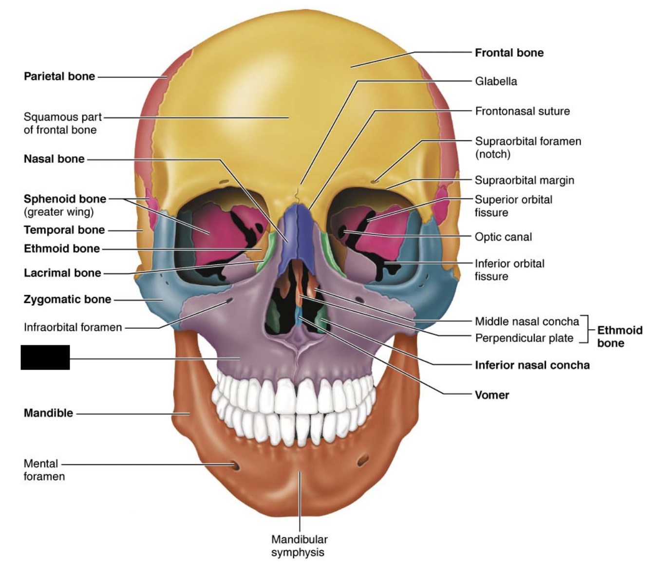 What facial bones is this?