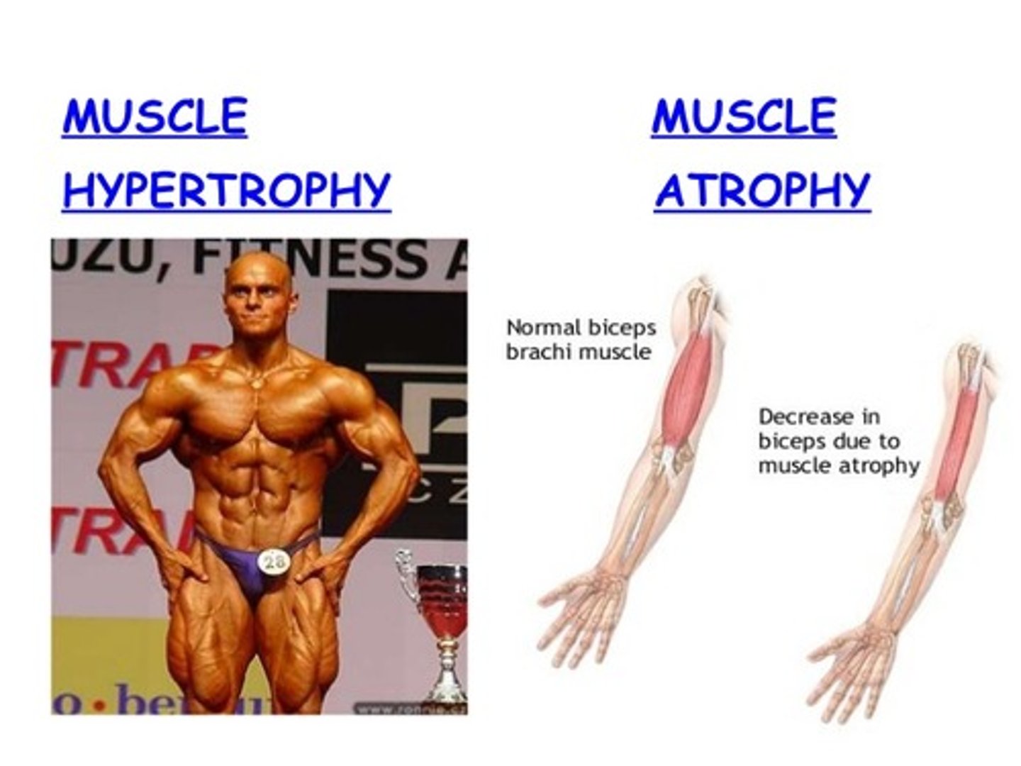 <p>True. Atrophy is a loss in muscle mass. Hypertrophy is the opposite of Atrophy and is a gain of muscle mass.</p>