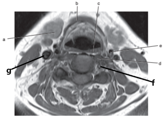 <p>What is letter g ?</p>