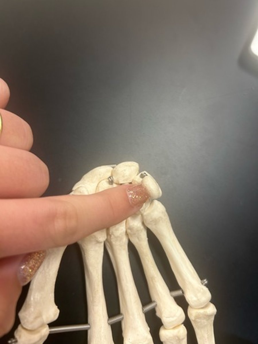 <p>name the bone</p>