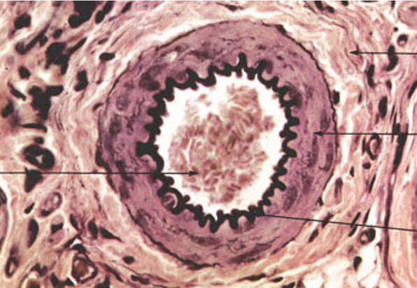 <p>Identify the blood vessel type</p>