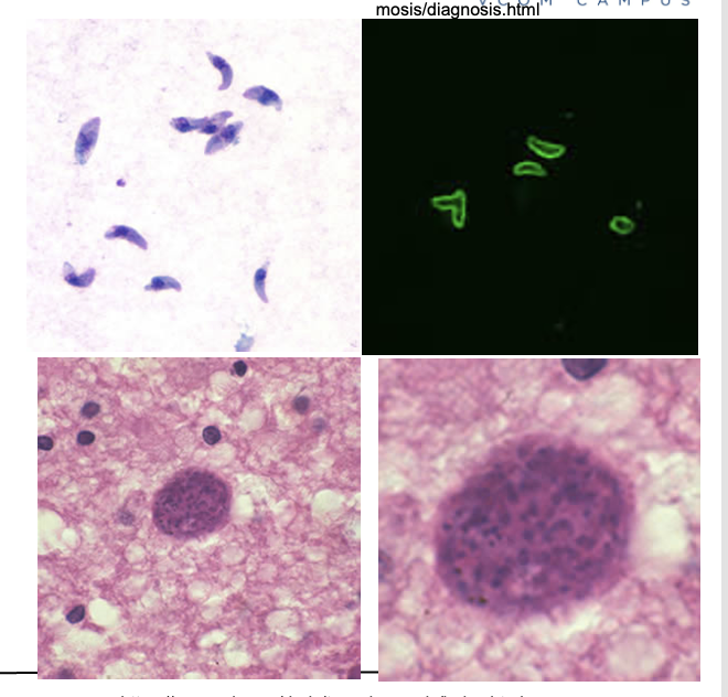 <ul><li><p class=""><strong>Pregnant women</strong></p></li><li><p class=""><strong>Immunocompromised individuals</strong>, especially:</p><ul><li><p class=""><strong>AIDS patients</strong></p></li><li><p class="">Those immunosuppressed for <strong>cancer or transplant</strong></p></li></ul></li></ul><p></p>