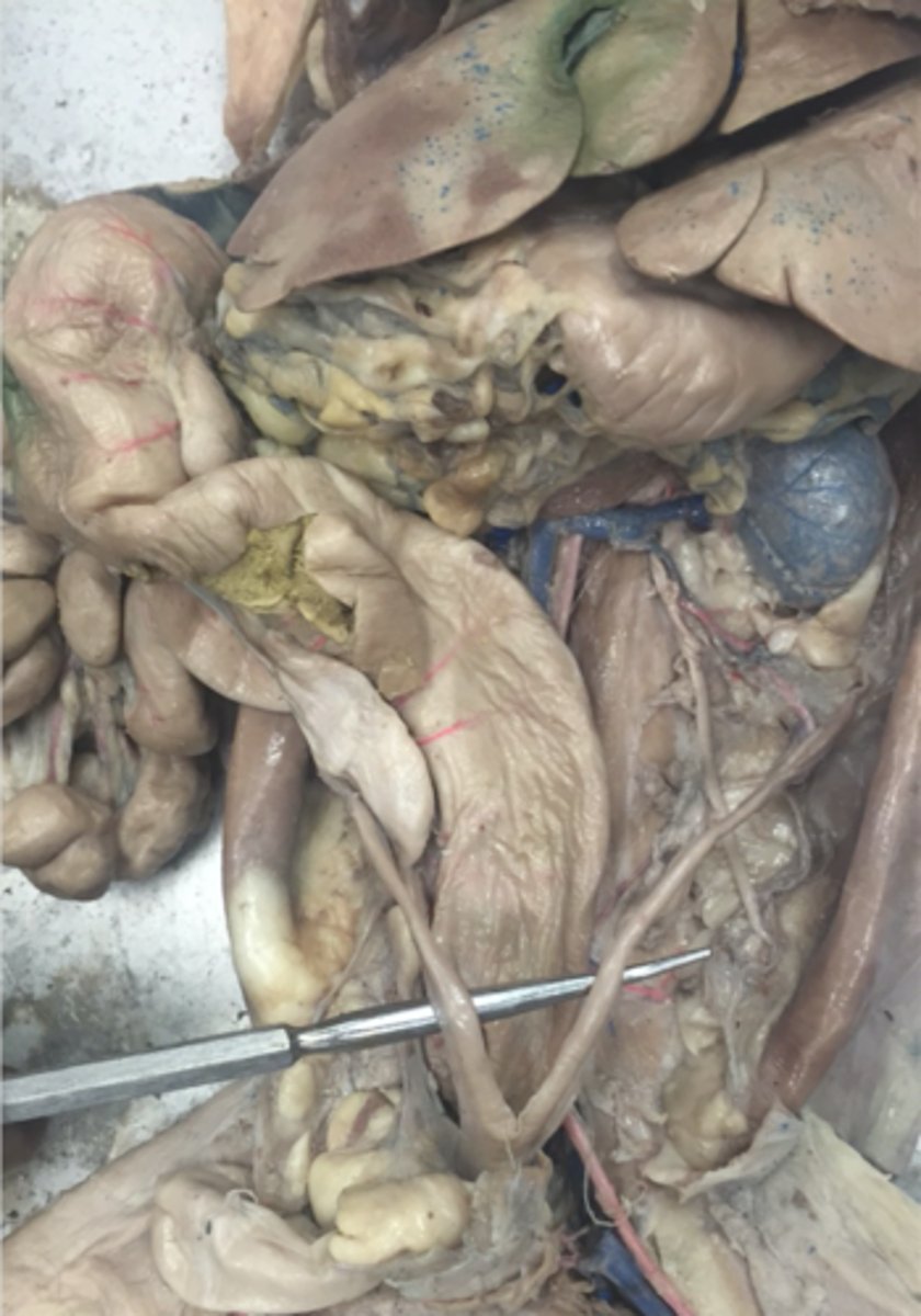 <p>Organ where fetal development occurs.</p>