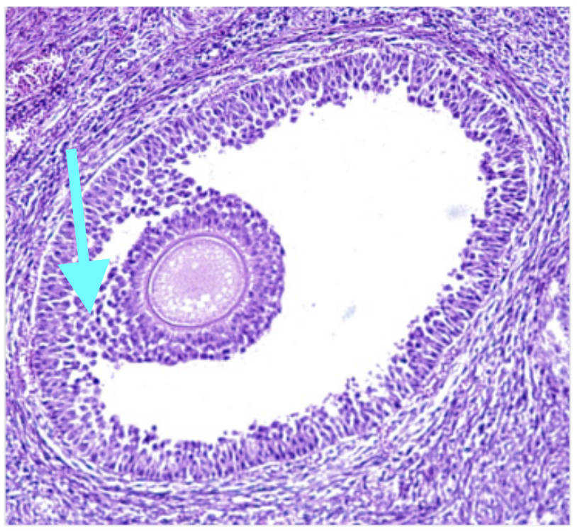 <p>What structure is shown (at arrow)?</p>