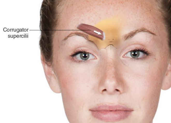 <p><strong>Corrugator Supercilii</strong></p>