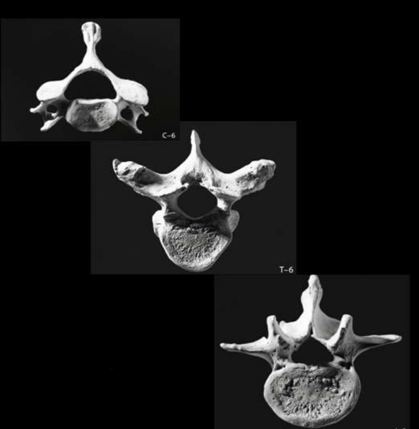 <p>Identify the cervical vertebrae</p>
