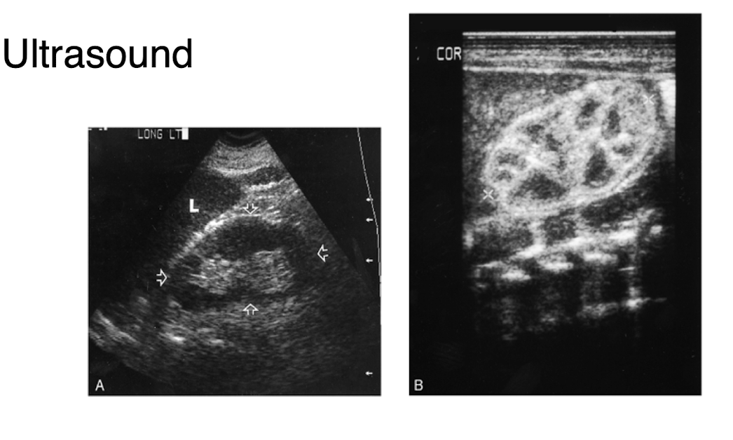 <p>What is shown in this ultrasound of the urinary system?</p>