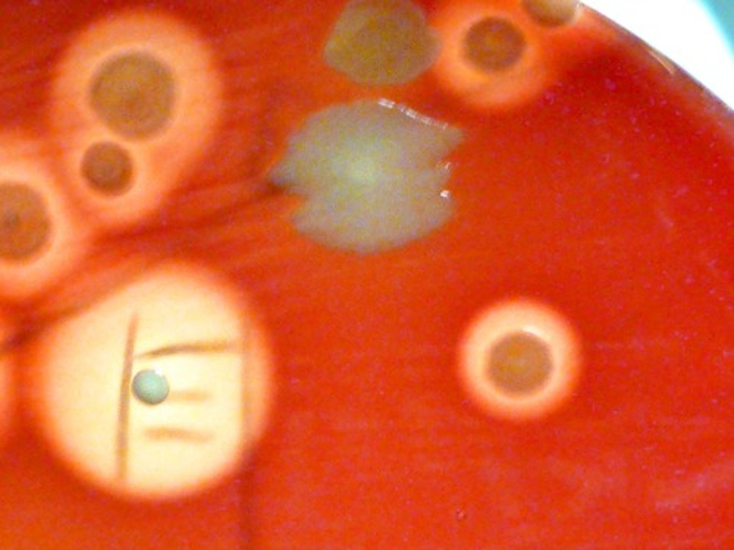 <p>Organisms with no ring exhibit</p>