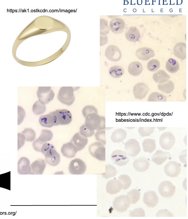 <ul><li><p class=""><strong>Trophozoite form</strong> = gamete, appears as <strong>signet ring</strong></p></li><li><p class=""><strong>Merozoite form</strong> = appears as <strong>Maltese cross</strong></p></li></ul><p></p>