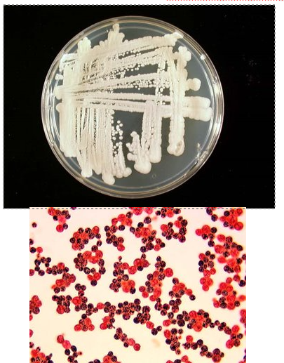<p>green algae that lacks chlorophyll</p><p>resembles yeast</p><p></p><p>round cells (sporangia) containing sporangiospores (endospores) no true budding</p><p>stains blotchy</p>