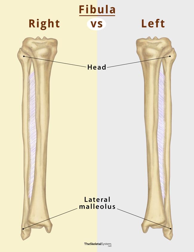 <p>Lateral Malleolus is pointed outwards with the head and not towards the tibia</p>