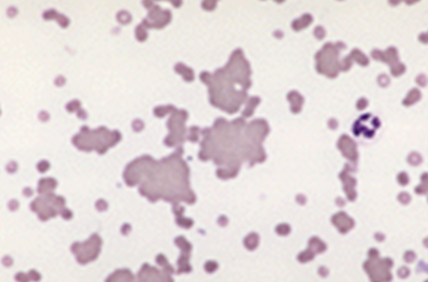 <p>clumping of red blood cells used in diagnostic tests to detect antibodies or antigens, such as in blood typing</p>