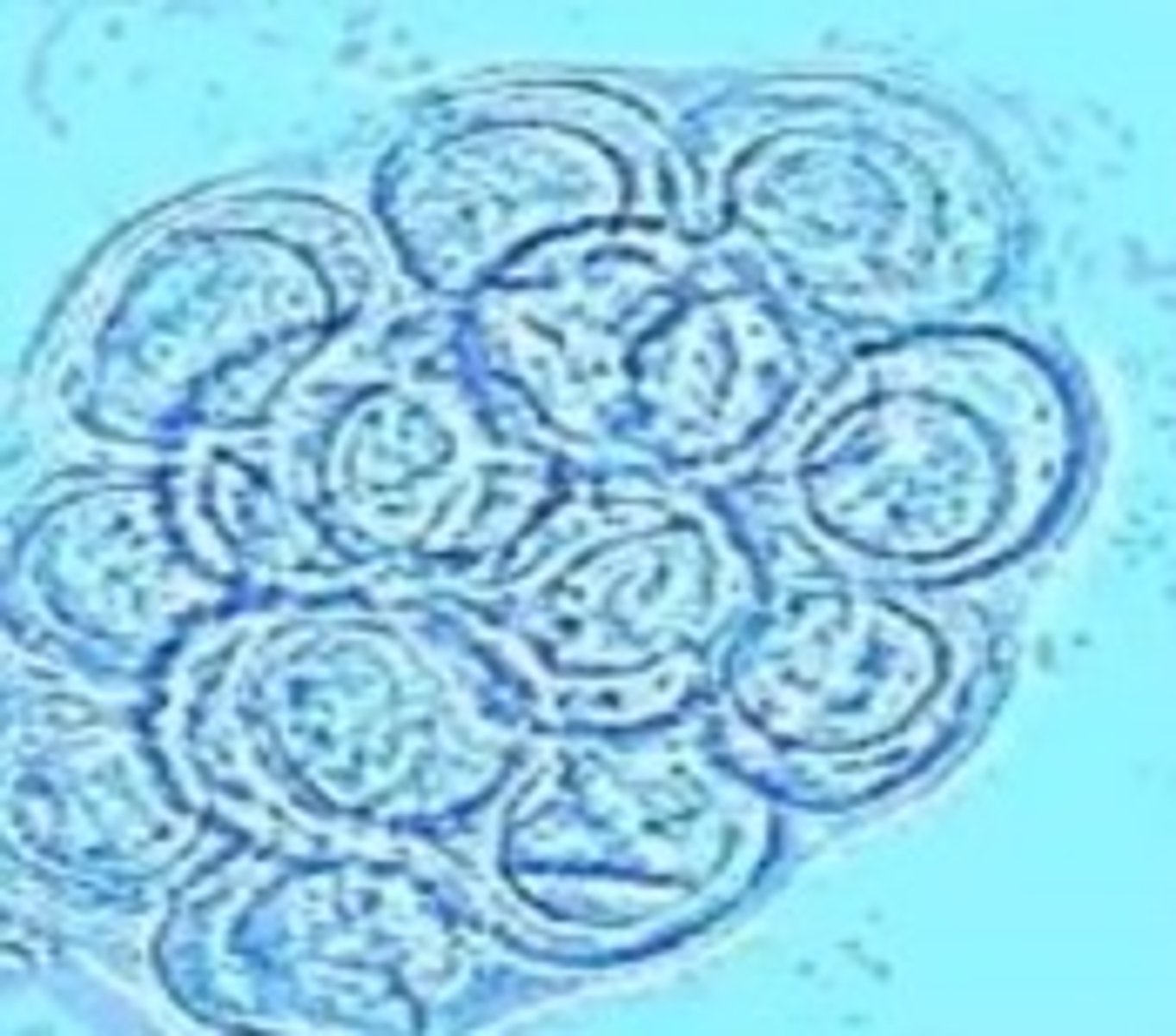 <p>Ingestion of a metacestode in infected vertebrate intermediate host</p><p>3 multiple choice options</p>