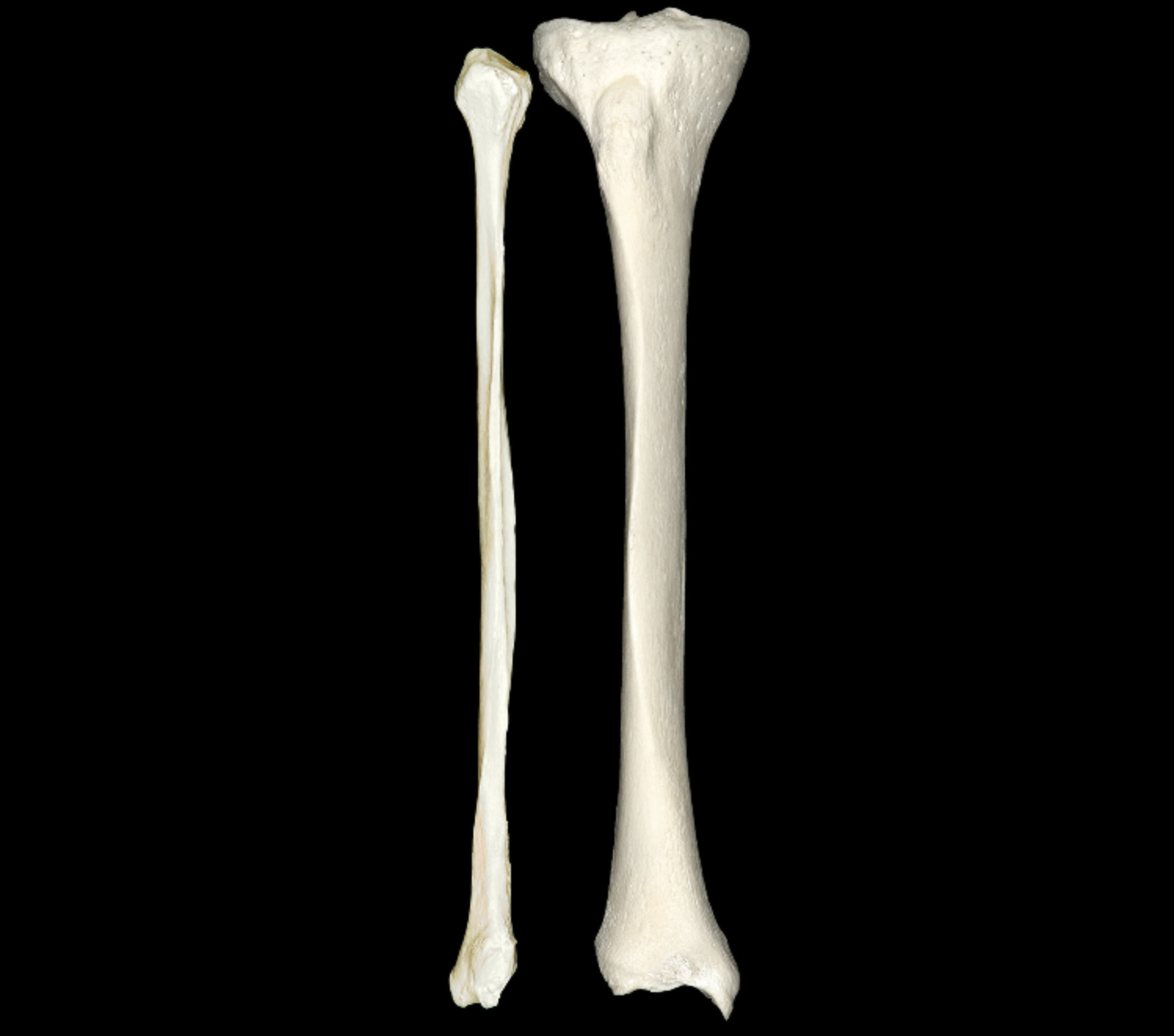 <p>thinner bone in the leg </p>