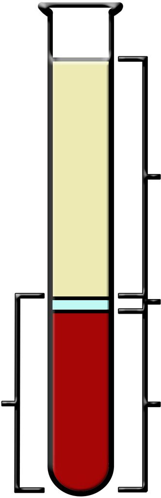 <p>the straw colored liquid in the upper part of the tube</p>