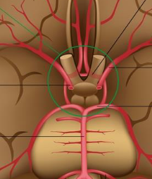 <p>Where is the anterior cerebral artery?</p>