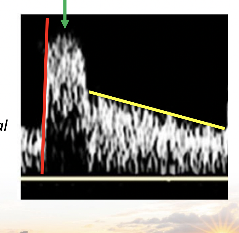 <p>Explain the parts of this waveform </p>