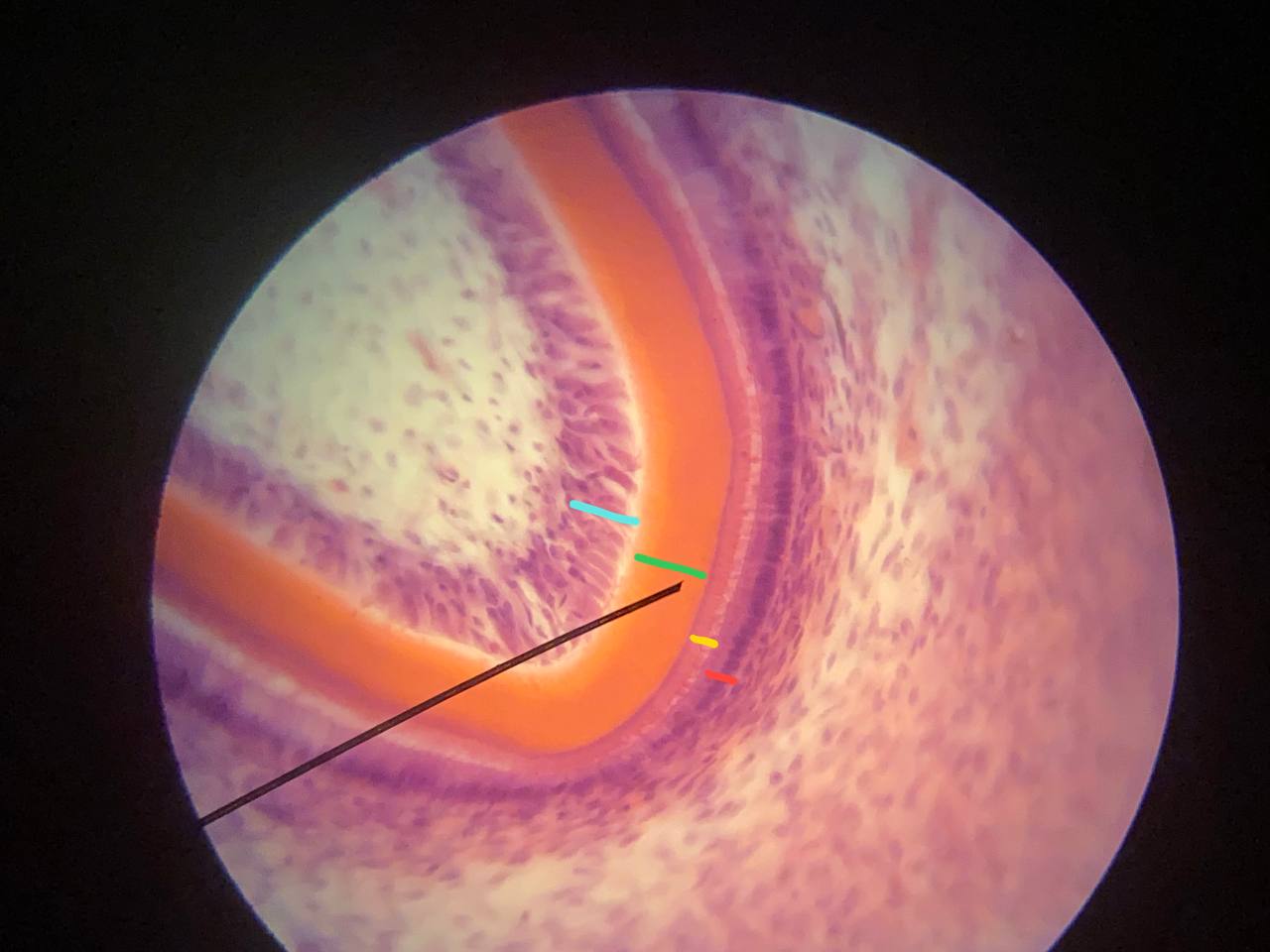 term image